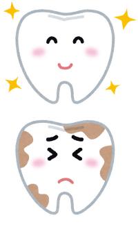 あなたの歯の寿命度を判定します!